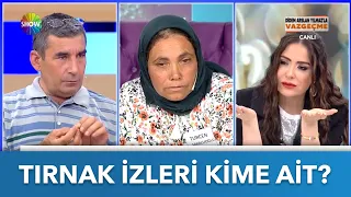 Gamze'nin boynundaki tırnak izleri kime ait? | Didem Arslan Yılmaz'la Vazgeçme | 20.06.2022