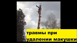 Травмы при удалении макушки деревьев