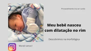 dilatação no rim do meu bebê descobrimos na ultrassom morfológica #mamae