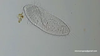 Ciliados anaerobicos marinos, probables Metopus - Anaerobic marine ciliates likely Metopus