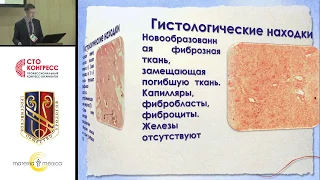 Часть I. Секция Доброкачественные заболевания предстательной железы