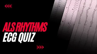 ALS Rhythms: ECG Quiz