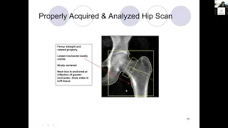 DXA Tech Training - Hologic