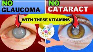 10 Vitamins to Prevent CATARACT and GLAUCOMA (Protect Your Eyesight)