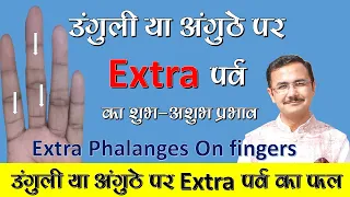 उँगलियों या अंगूठे में extra पर्व होने पर क्या होता है ? || Extra phalanges in fingers | lesson- 122