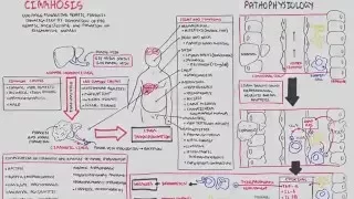 Liver Cirrhosis (SandS, Pathophysiology, Investigations, Management)