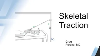 Webinar: Skeletal Traction: How, When and What works