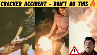 Funny Fire Accident 😆| Diwali Crackers 💥 | Fireworks | Diwali Incident | Cracker Funny Video | Tamil