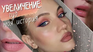 УВЕЛИЧЕНИЕ ГУБ | ВСЯ ПРАВДА | мой опыт | КАК ЭТО БЫЛО? | ВСЕ СЕКРЕТЫ | 1 ml это много или мало?