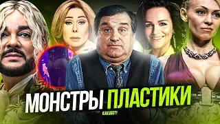 ЖЕРТВЫ ПЛАСТИЧЕСКИХ ОПЕРАЦИЙ | ПЕРЕКРОЕННЫЕ ЗВЕЗДЫ | КИРКОРОВ, СЛАВА, РУДКОВСКАЯ, КТО ЗА ХАЙДАРОВА?