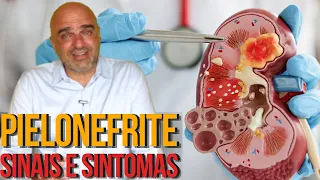 INFECÇÃO dos RINS: o que é pielonefrite? O que causa? Quais os sintomas? Como tratar?