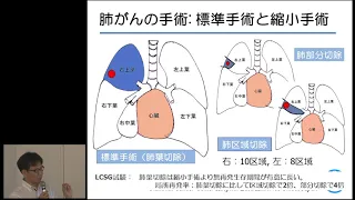 Japan Cancer Forum2019「肺がんの外科治療 ～自ら治すために手術前後に理解しておくべきポイント～坪井 正博先生