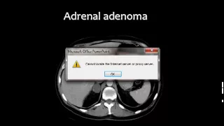 Imaging of Adrenal gland Dr Mamdouh Mahfouz