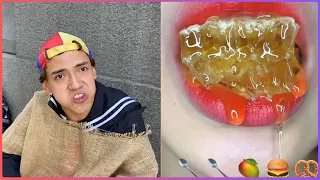 Los Mejores Tiktoks de @Rubén Tuesta  || MORIRAS DE RISA 🤣😺😍 ASMR EMOJI Eating Parte 1