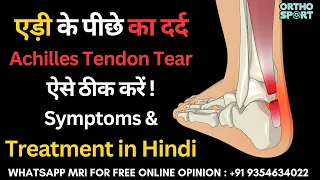 एड़ी के पीछे का दर्द, Achilles Tendon Tear ऐसे ठीक करें, Symptoms & Treatment in Hindi, #TA Tear