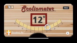 Messen und überwachen Sie Ihre Skoliose auf Ihrem Telefon mit der Skoliometer-App
