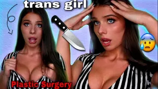 Transgender Top Surgery MtF Augmentation Storytime