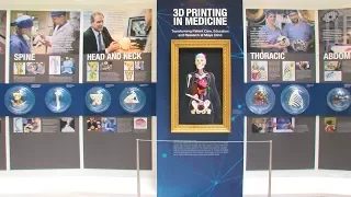 Mayo Clinic Minute: How 3D imaging helps doctors and patients