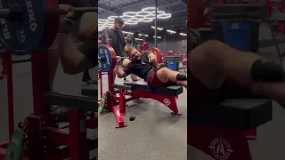 Pec Tear Bench Press