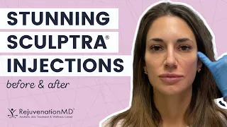 Sculptra Face Injections: Anti-Aging Treatment for Healthier, Younger-Looking Skin