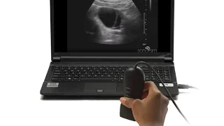 Ultrasound Video Challenge - OB-GYN