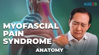 Myofascial Pain Syndrome | How to RELIEVE TRIGGER POINTS | Treatments, Animation