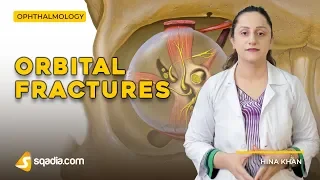 Orbital Fractures | Miscellaneous Conditions | Ophthalmology Lectures | V-Learning