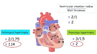 HOW THE HEART ADAPTS TO EXERCISE!  CARDIOVASCULAR ADAPTATIONS THAT INCREASE VO2max!