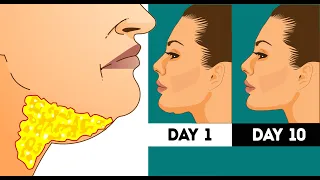 FACE FAT + DOUBLE CHIN | BEST FACIAL EXERCISES FOR WOMEN