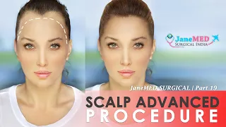 Scalp Advanced Procedure | JaneMED SURGICAL | Part 19