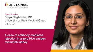 A case of antibody mediated rejection in a zero HLA antigen mismatch kidney