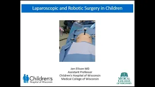 6.30.2020 PedsUroFLO - Laparoscopic and Robotic Surgery in Children