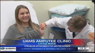 (FOX16) UAMS Amputee Clinic