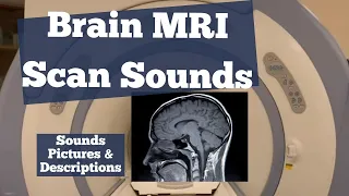 Exploring Brain MRI Scan Sounds and Protocols