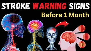 Detect it Quickly || 7 STROKE Symptoms 1 month Before it Happens || Stroke