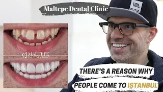 A Complete Smile Makeover Experience in Turkey | Maltepe Dental Clinic, Istanbul