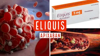 ELIQUIS ( Apixaban ) 5 mg , 2.5 mg - TOUT CE QUE VOUS DEVEZ SAVOIR