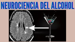 Neurociencia del alcohol y el alcoholismo