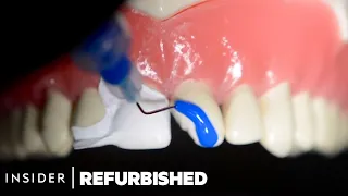 How Damaged Teeth Are Professionally Restored | Refurbished | Insider