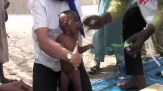 Chad: On the Brink of a Peak in Malnutrition