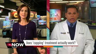 Ask Dr. Nandi: Does 'Cupping' actually work?