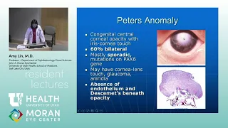 Congenital Anomalies of the Cornea, Sclera and Globe