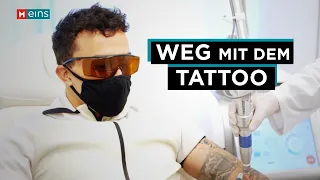 Langwierig und teuer: So läuft eine Tattooentfernung ab | MEINS Reportage