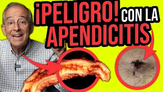 PELIGRO APENDICITIS RIESGO DE MUERTE POR ESTO SE ENFERMA EL APENDICE - Oswaldo Restrepo RSC