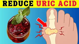URIC ACID blues? try these AMAZING foods! (No Pills Needed) | Little Bit Healthier