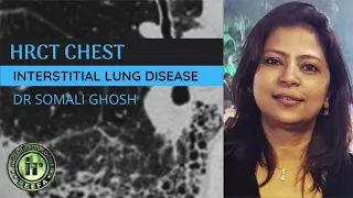 DR SOMALI GHOSH | HRCT INTERSTITIAL LUNG DISEASE | INTRODUCTION & CLASSIFICATION | UIP | NSIP | IPF