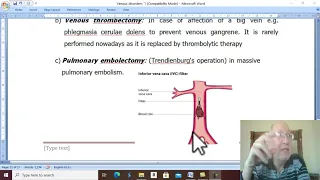 Venous Disorders in Arabic 7 ( Treatment of  DVT , ) , by Dr. Wahdan .