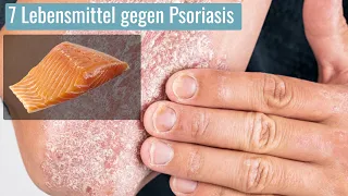 Meine Top 7 Nahrungsmittel zur Entgiftung bei Psoriasis durch deine Leber | #entgiften