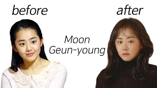 Moon Geun-young before and after