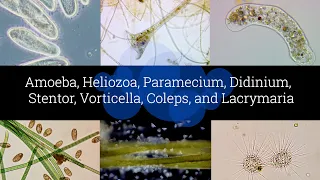 Microscopic Organisms in a Drop of Pond Water - Episode 2